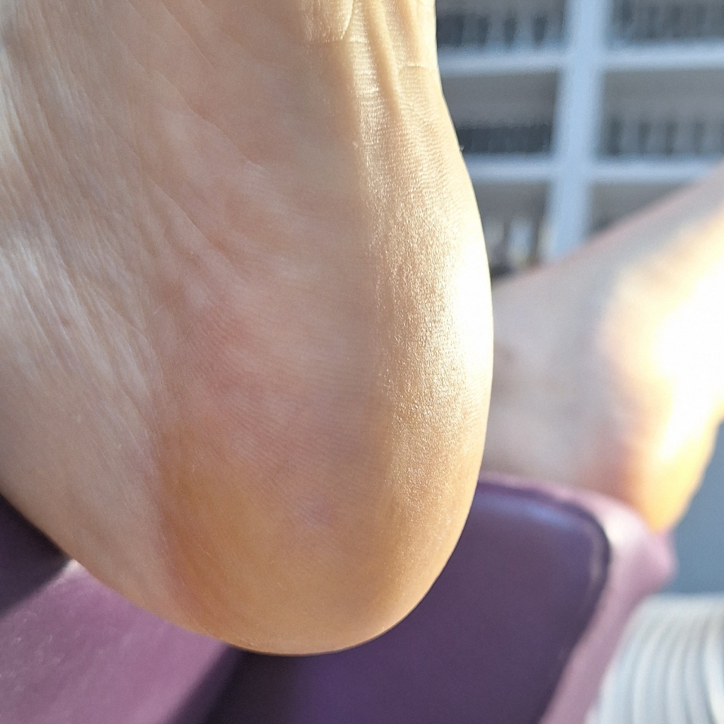 Обработка пяточек