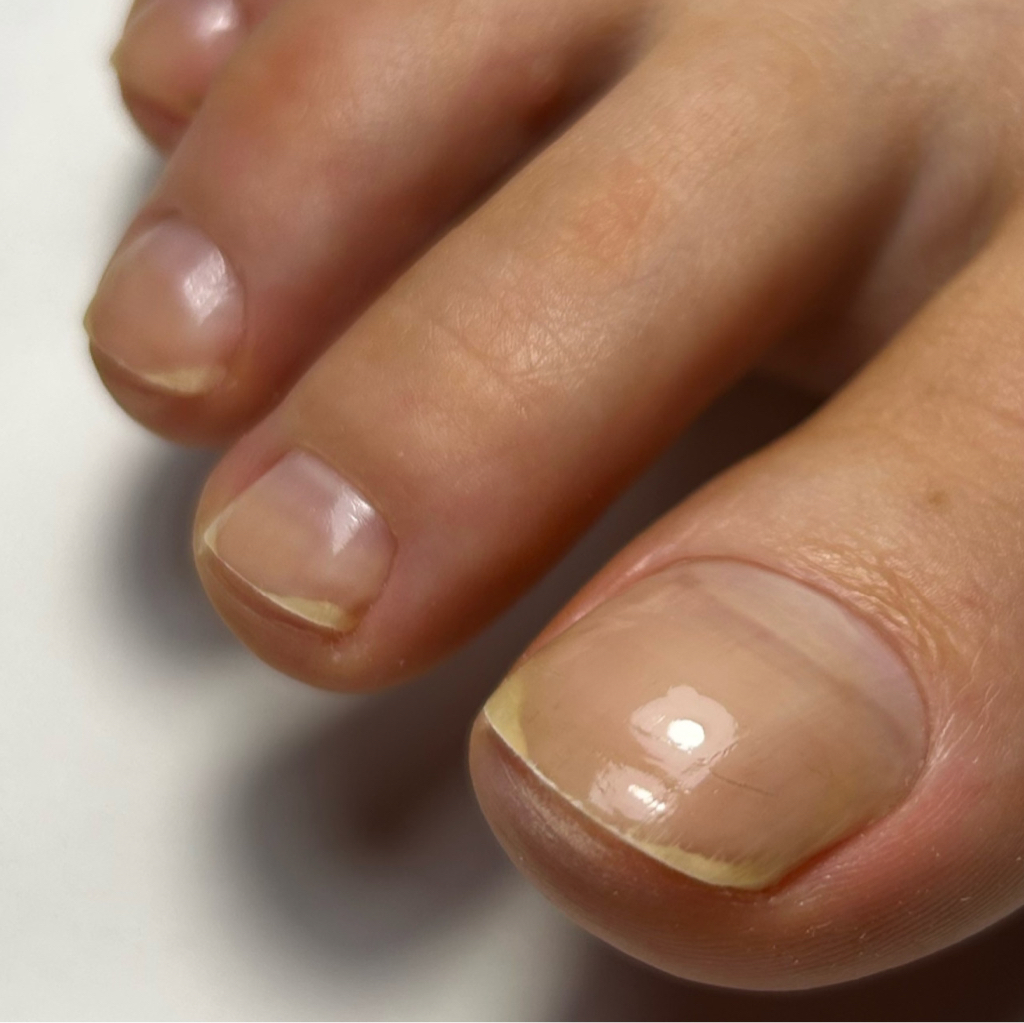 Гигиенический педикюр(без покрытия)