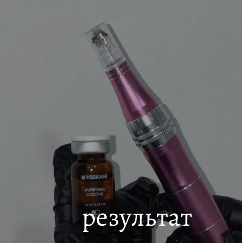 Эстетическая коррекция рубцов и растяжек на коже