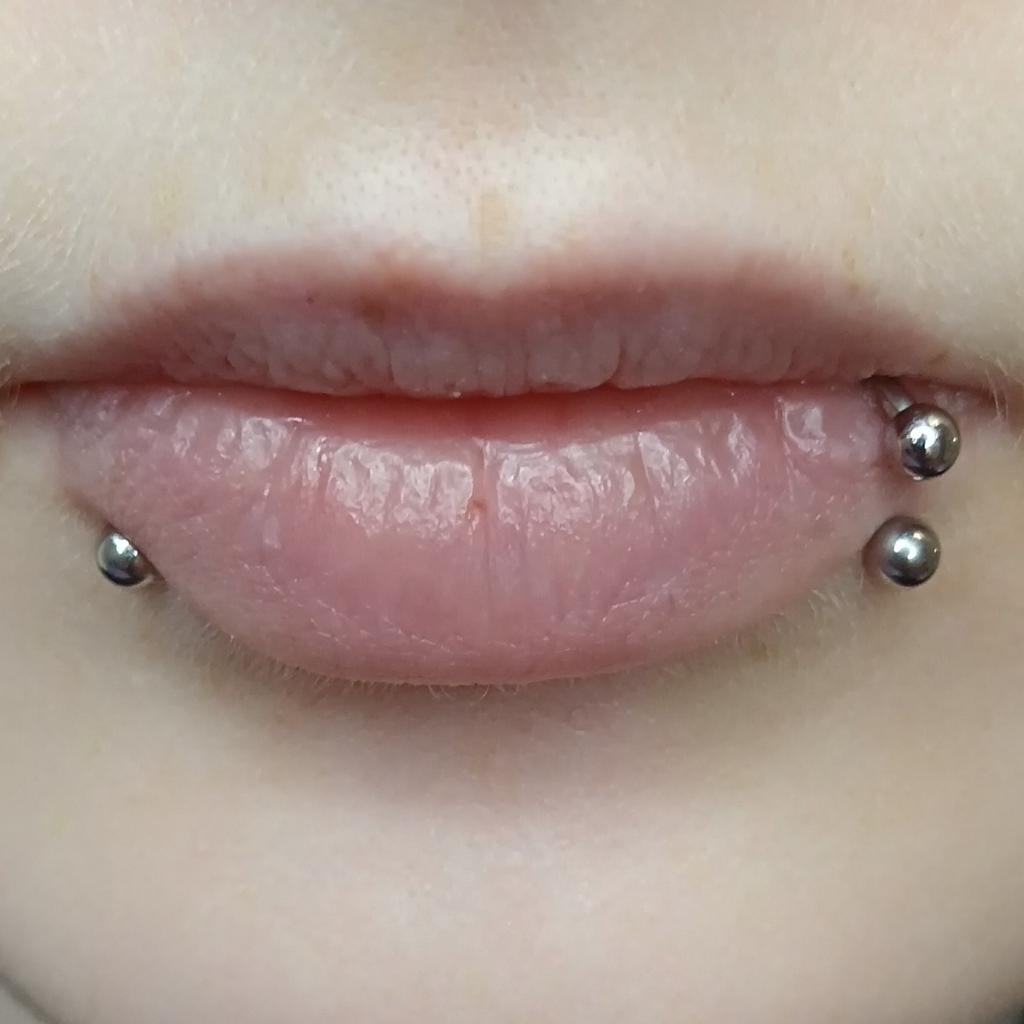 Симметрия губ (укус змеи)