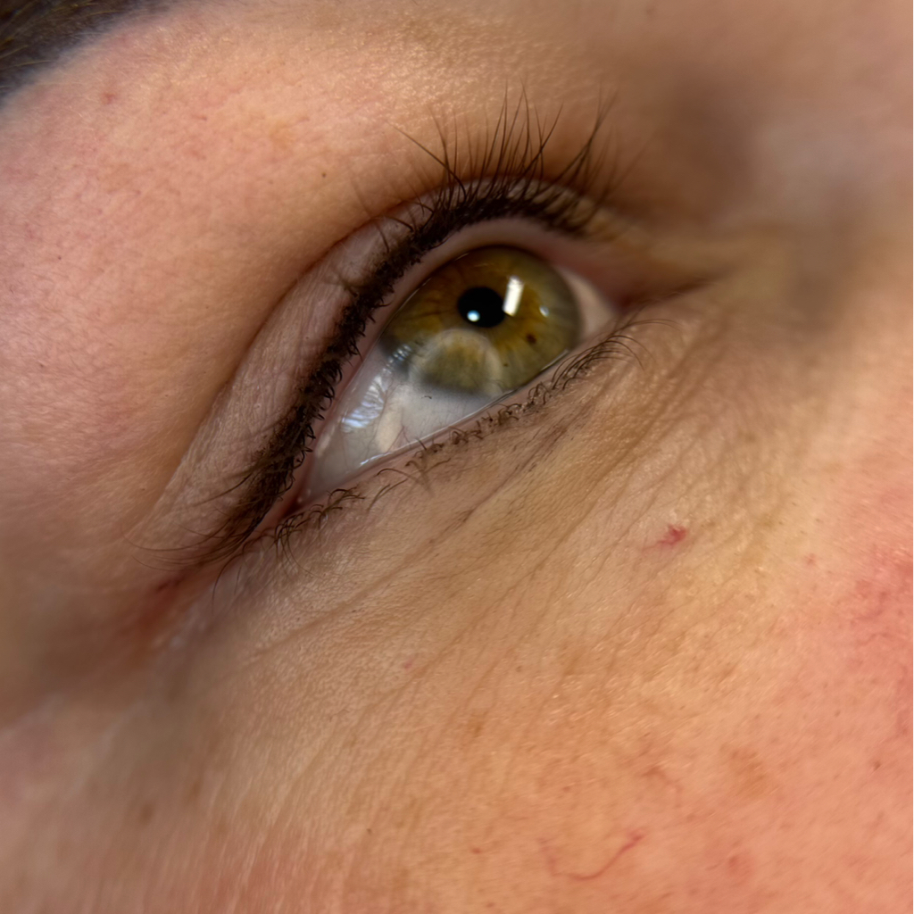 Межресничка