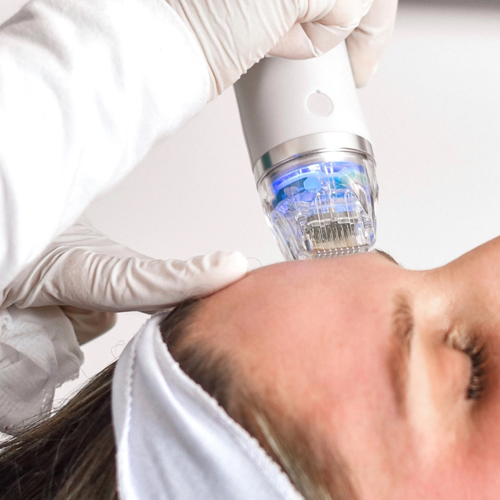 RF-лифтинг / Лицо