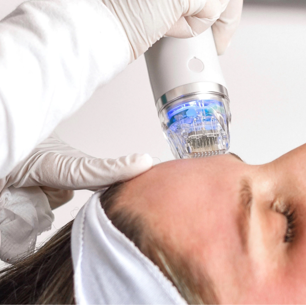 RF-лифтинг / Шея + декольте