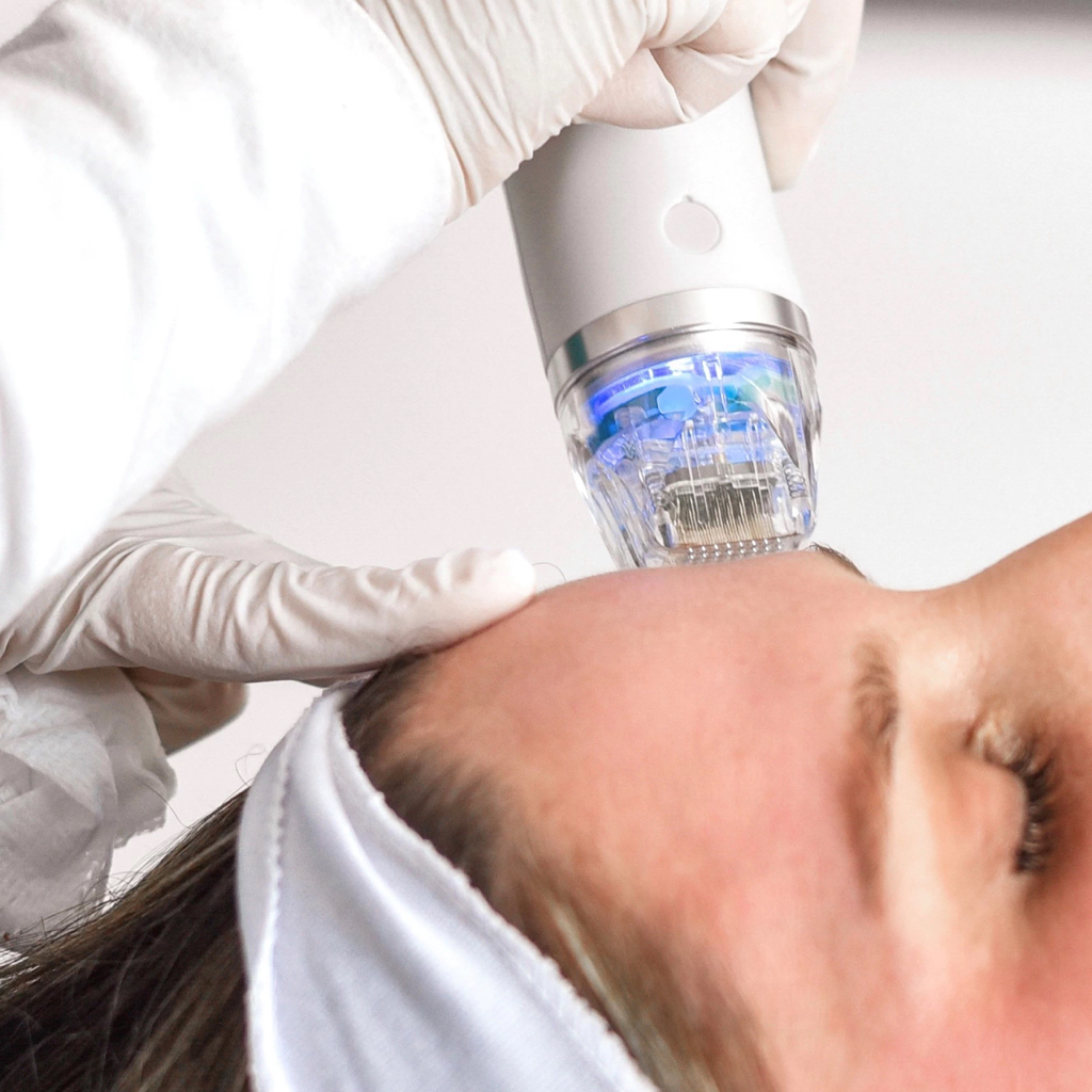 RF-лифтинг / Декольте