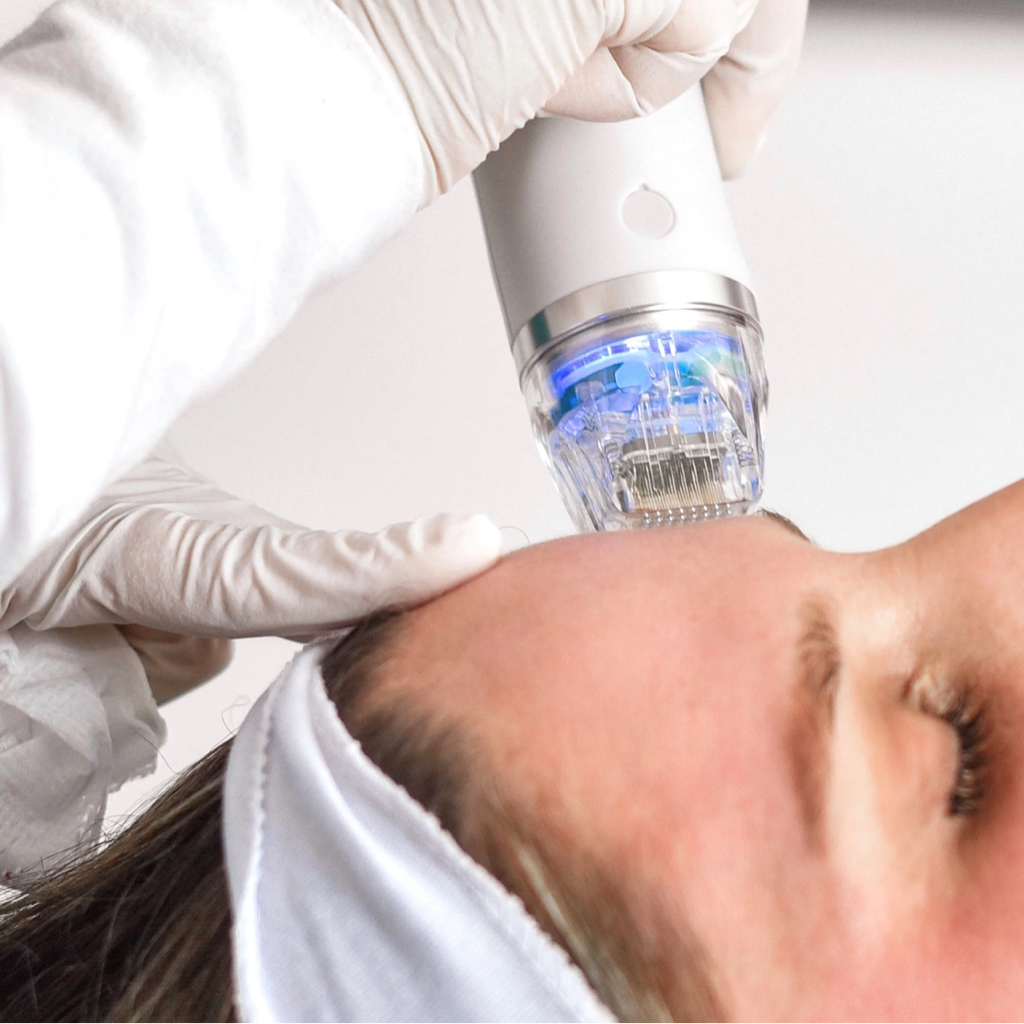 RF-лифтинг / Шея