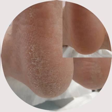 ПАКЕТ S ( педикюр )