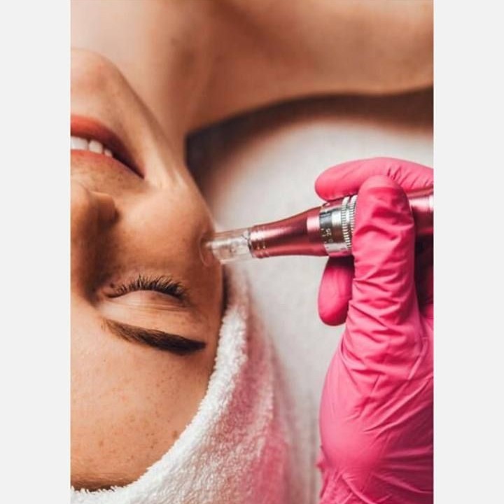 Фракционная мезотерапия зоны глаз