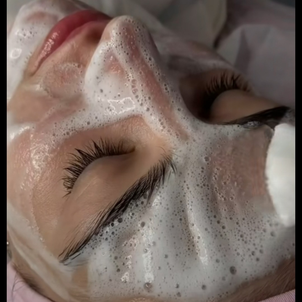 Карбокситерапия