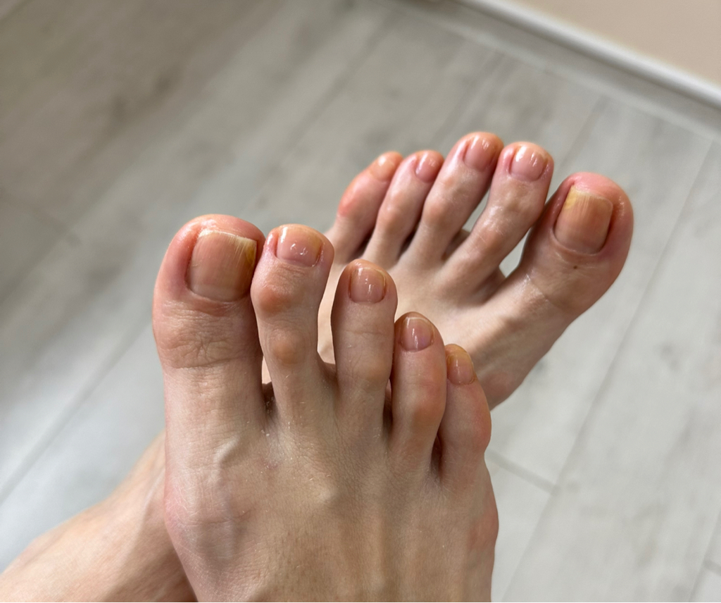 Снятие гель лака + педикюр