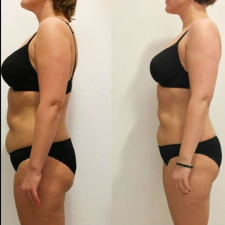 КОНСУЛЬТАЦИЯ бесплатно