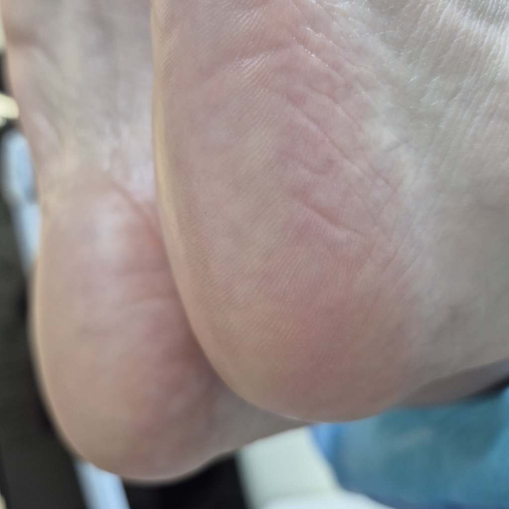 Педикюр Аппаратный 
стопа + пяточка (без пальчиков)
Кабинет 8