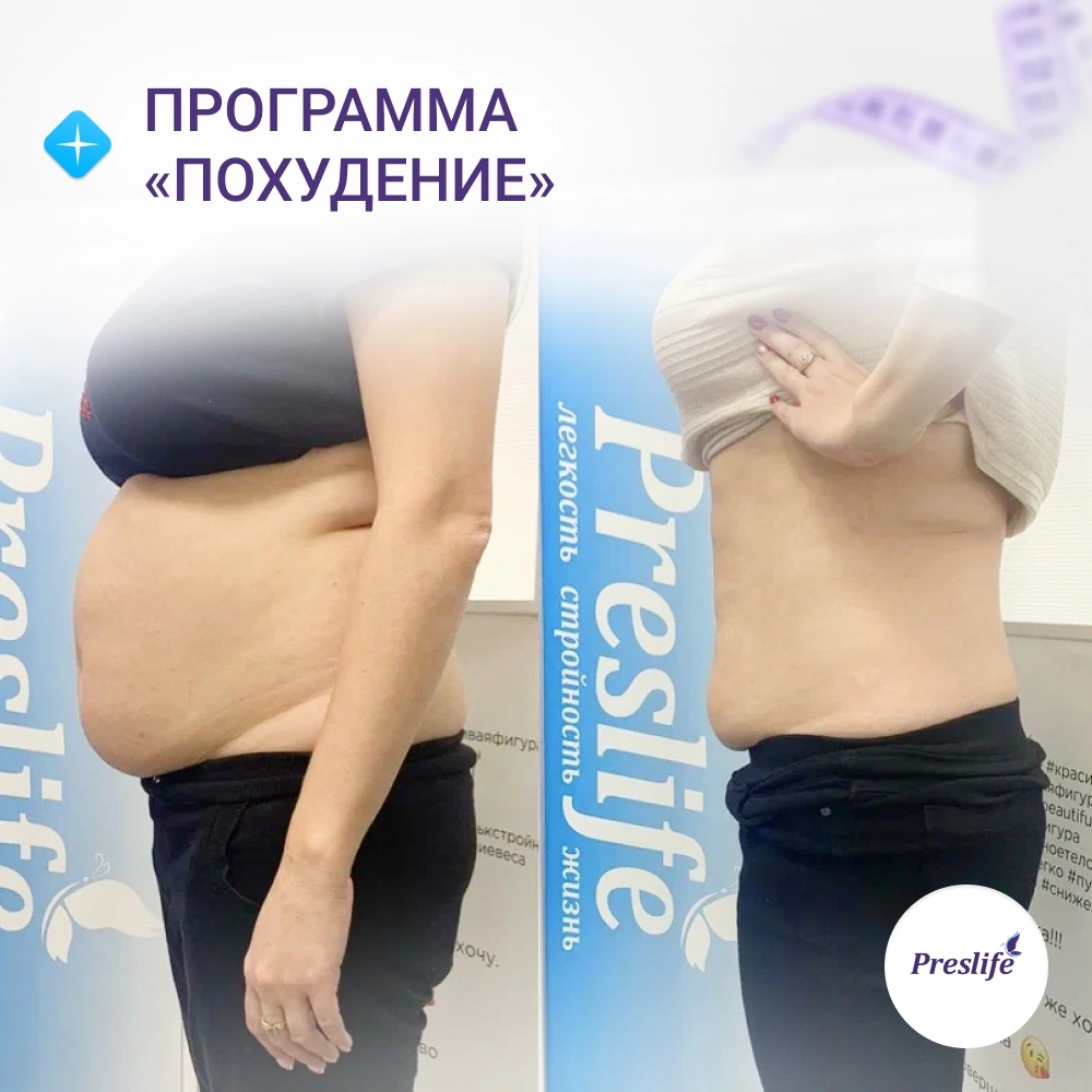 Программа «Комплексное похудение»