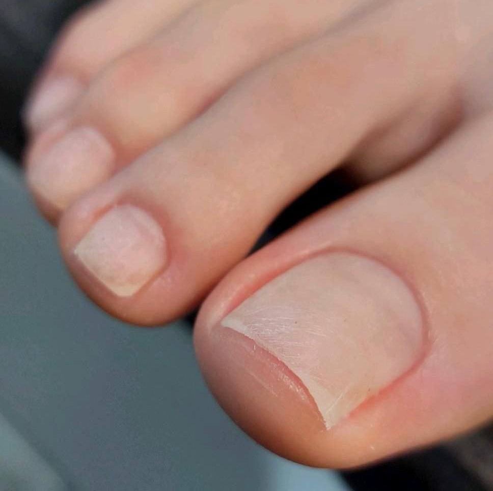 🔸Педикюр БЕЗ покрытия (входит снятие + обработка пальчики)