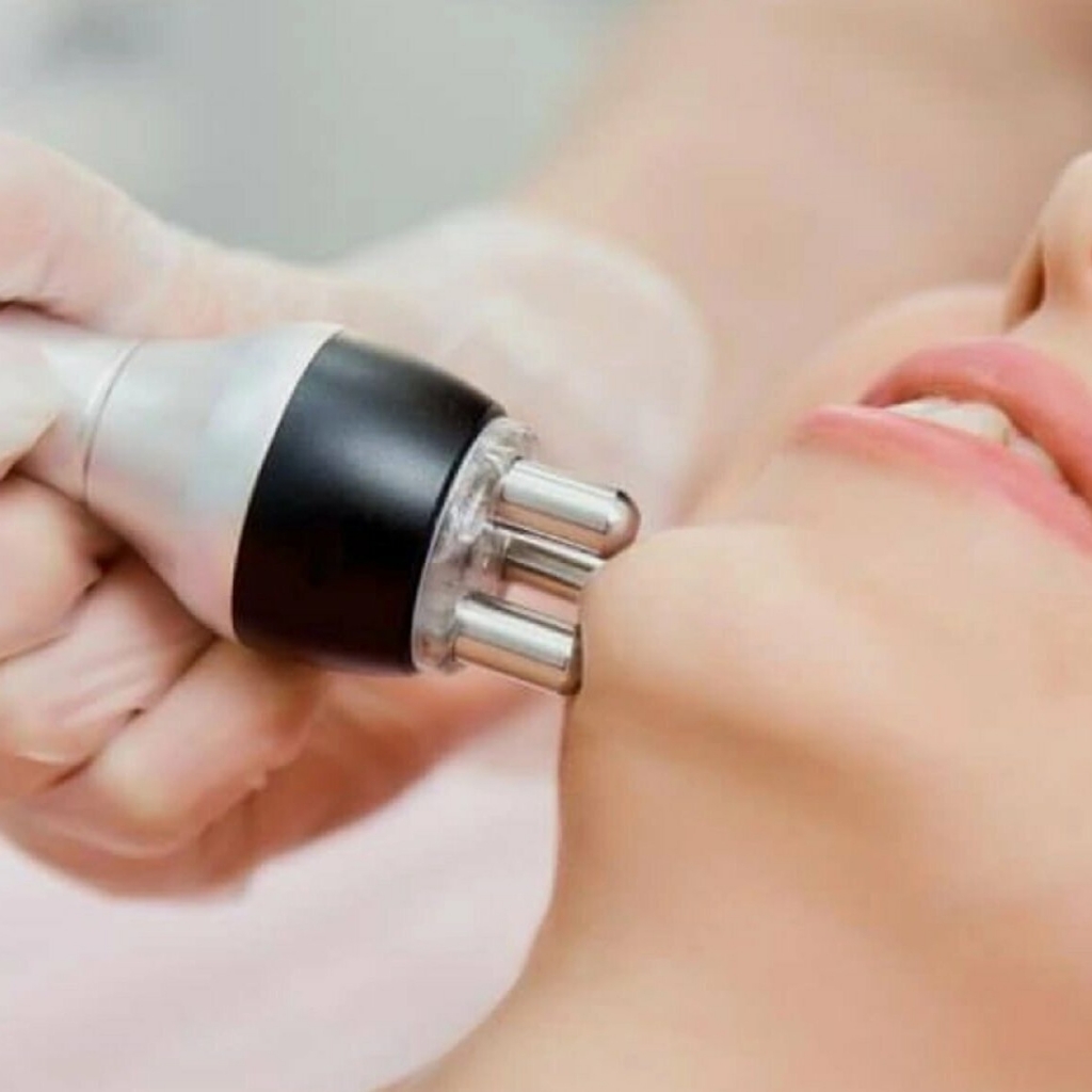 Rf лифтинг + безупречный овал