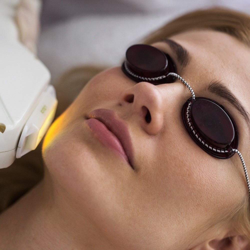 Карбоновый пилинг + фотоомоложение + лечение на выбор ( пигмент/акне/купероз)