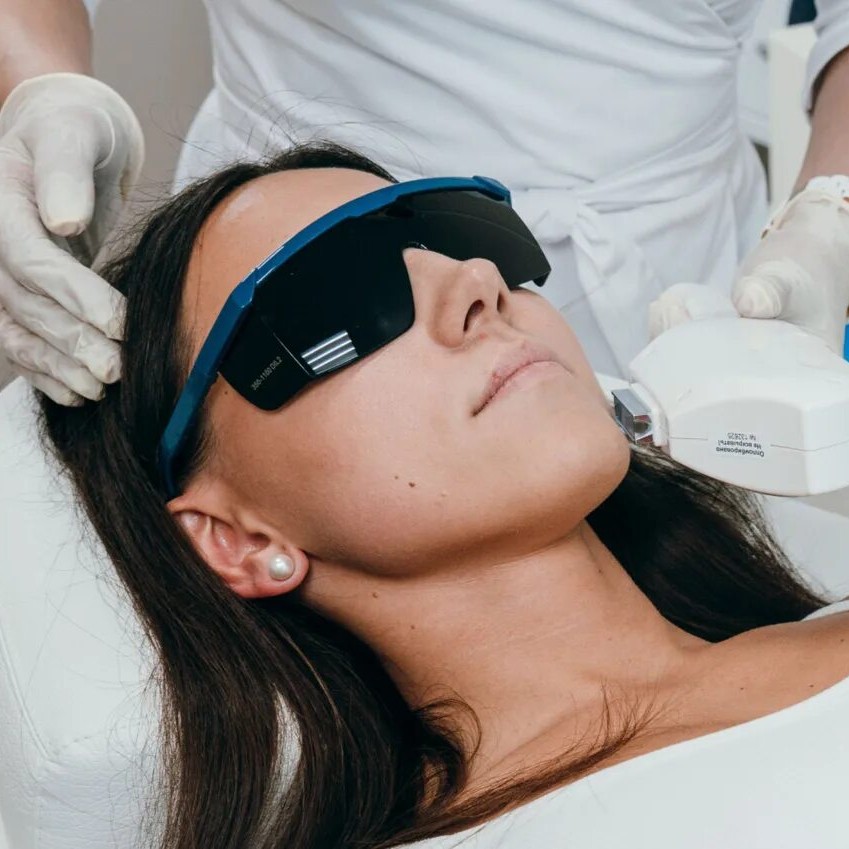 Фотоомоложение лицо+ Лечение пигмента