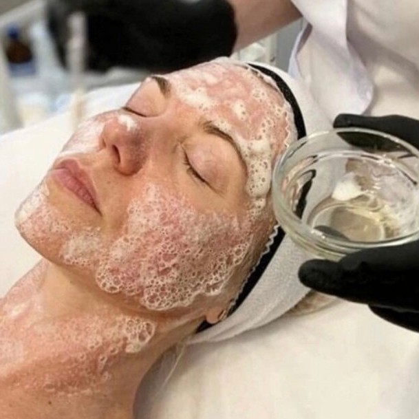 Неинвазивная карбокситерапия (насыщение кожи кислородом)