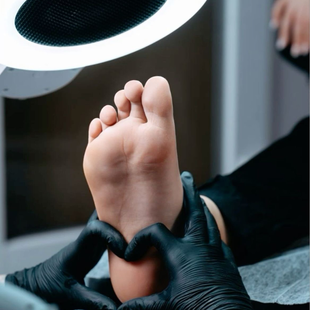 Онихолизис 1 ед