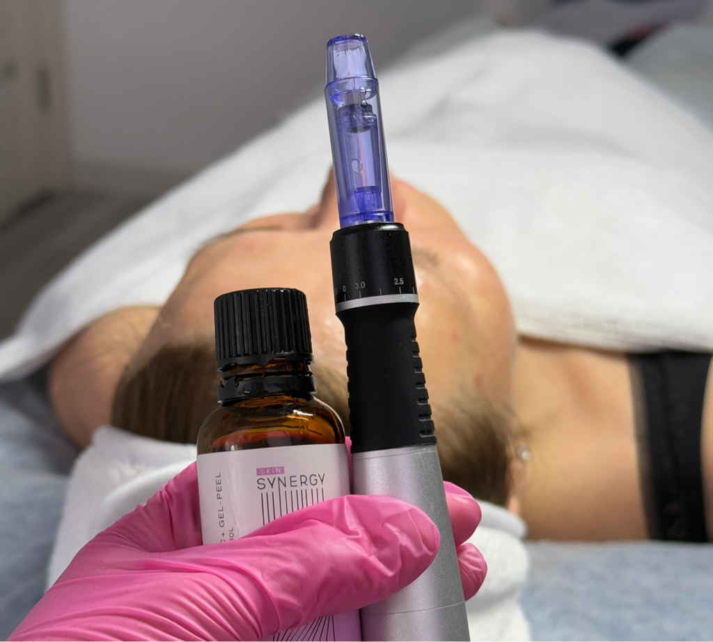 Мезопил - комбинированный метод, объединяющий преимущества пилинга и фракционной мезотерапии.