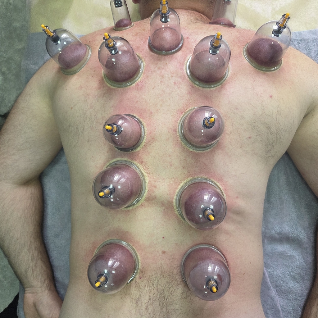 Массаж спины с постановкой банок