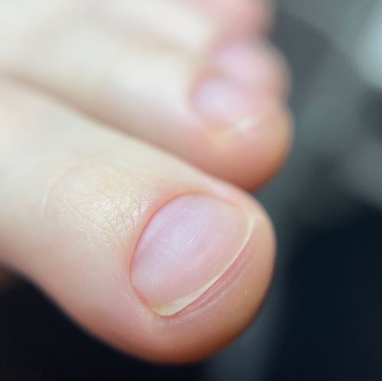 Обработка пальцев на ногах