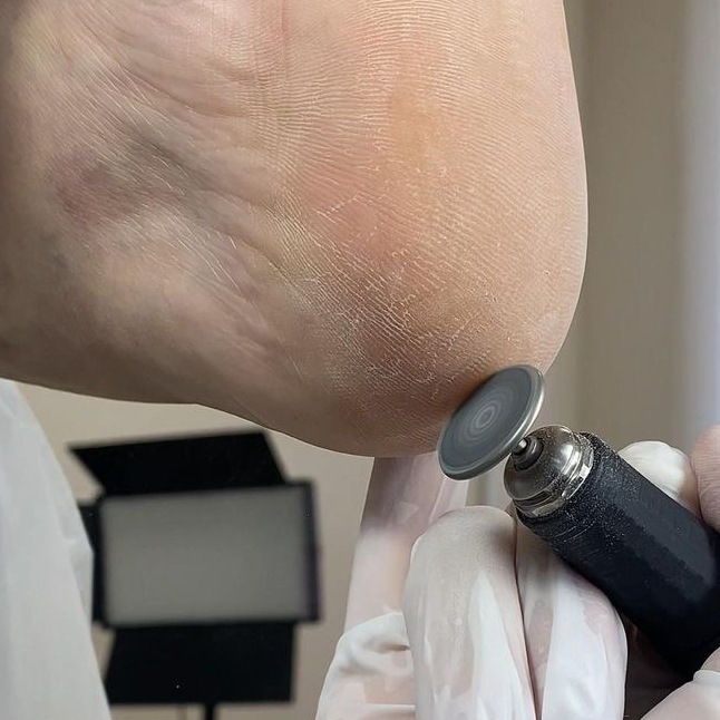 Обработка стопы