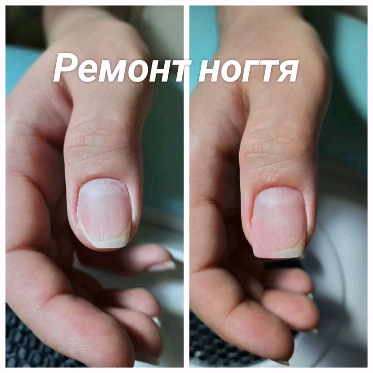 Ремонт ногтя( трещины/сколы)