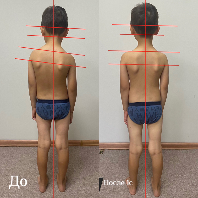 Звуковая квантовая остеопатия Дети (до 10л)