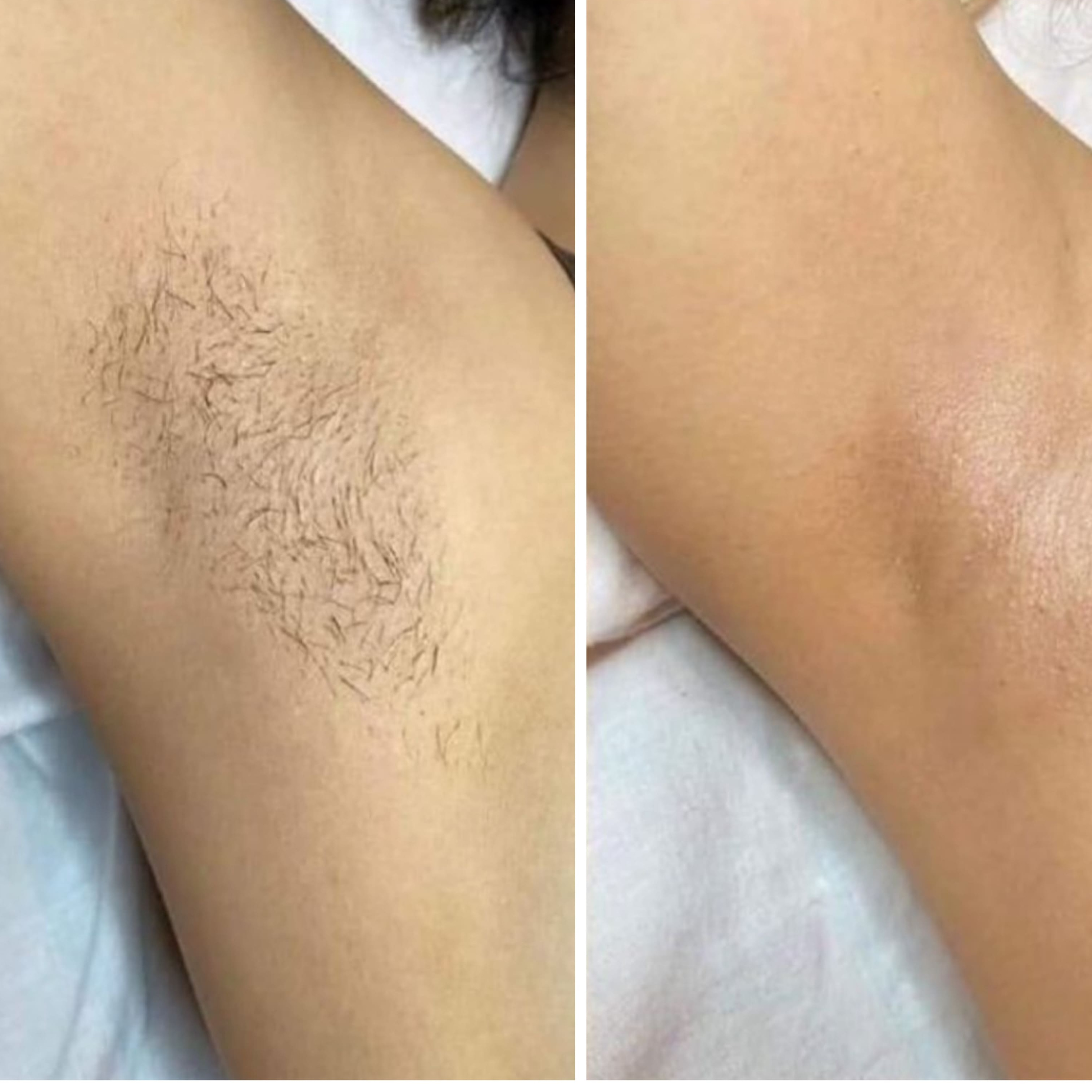 подмышки -воск