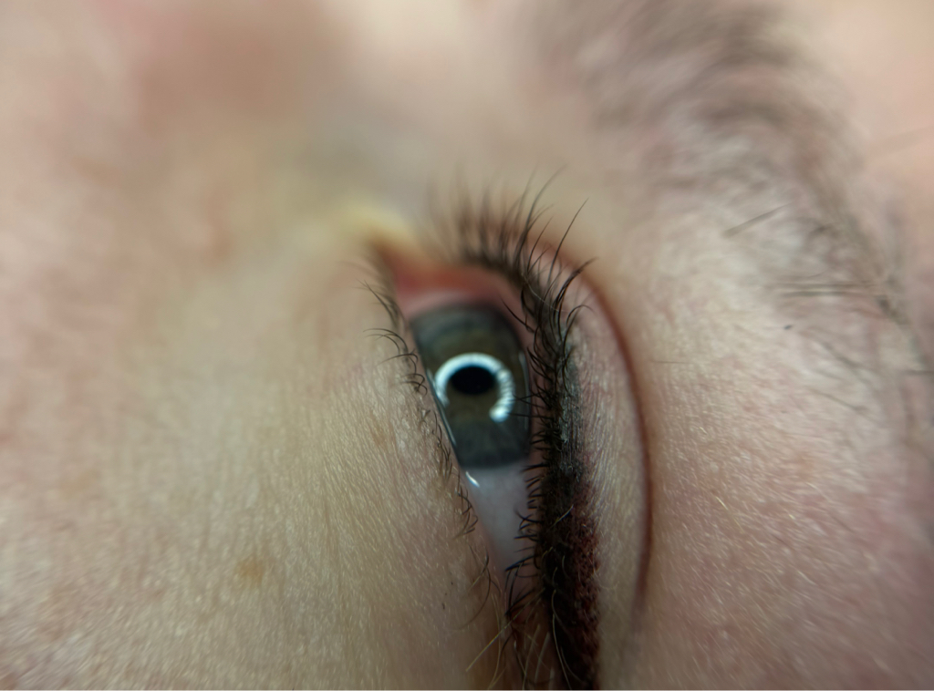 РЕФРЕШ обновление зоны ПМ век через год и более