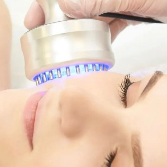 Фотонотерапия