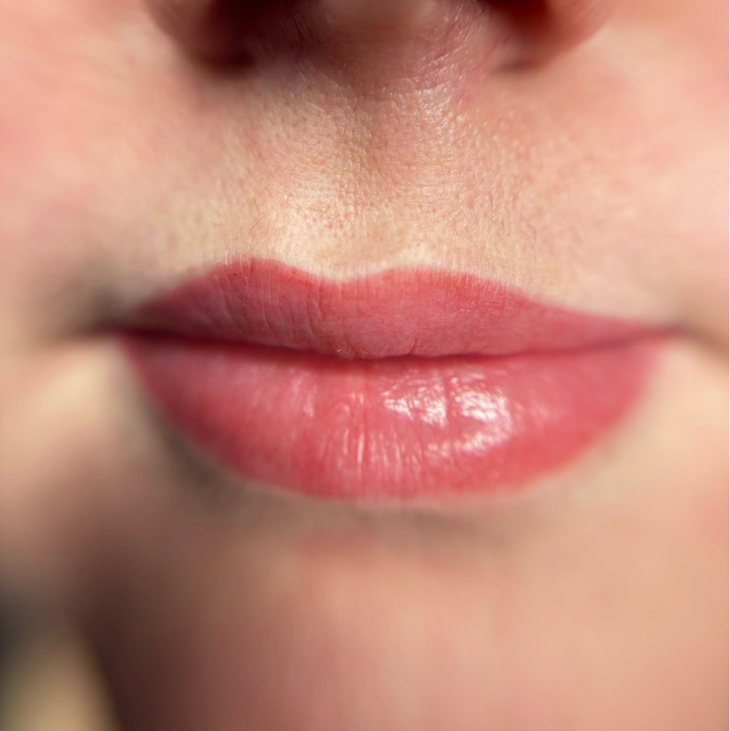 РЕФРЕШ обновление зоны ПМ губ через год и более