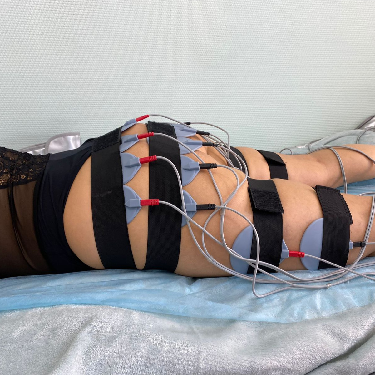 Электромиостимуляция (ЭМС), 30 мин. (10 сеансов)