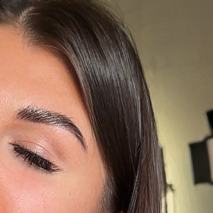 Сложная коррекция (обильное прореживание, полная архитектура)