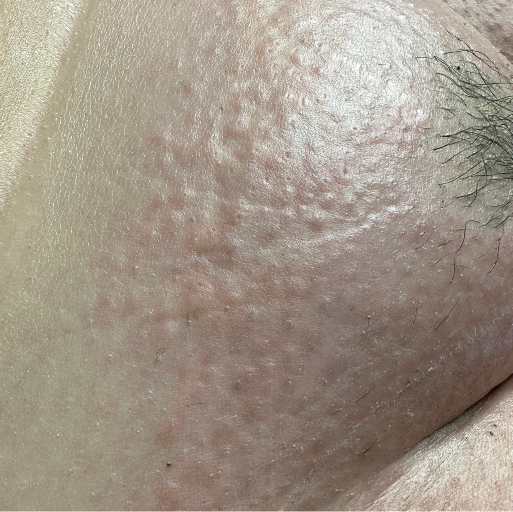 Бикини среднее