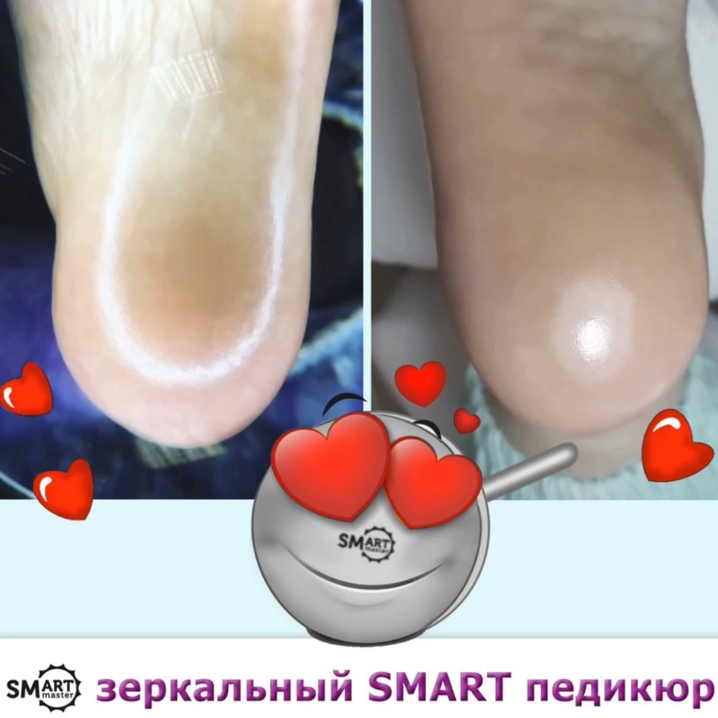 SMARTпедикюр
