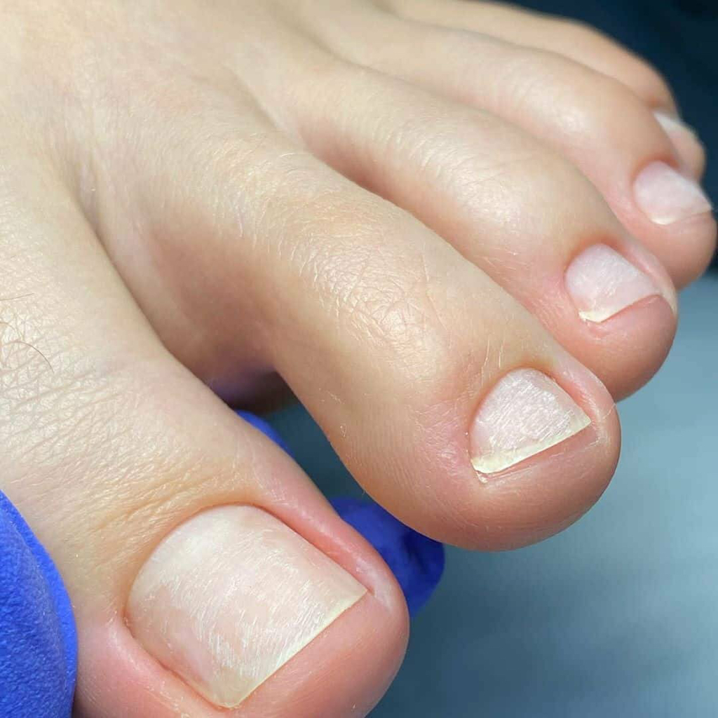 Снятие гель-лака без обработки  (педикюр)