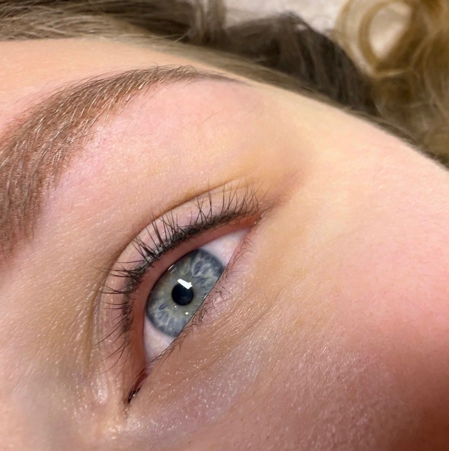 Коррекция межреснички