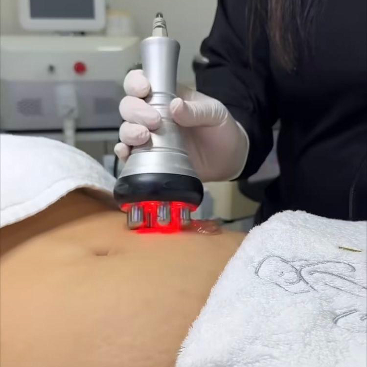 RF живот, бока