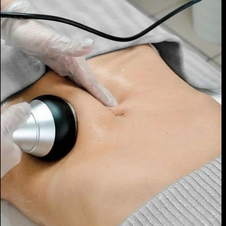 Ультразвуковая кавитация+RF вакуум