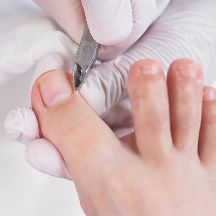 3.МЕДИЦИНСКИЙ ПЕДИКЮР 3 СТЕПЕНИ (СЛОЖНЫЙ)