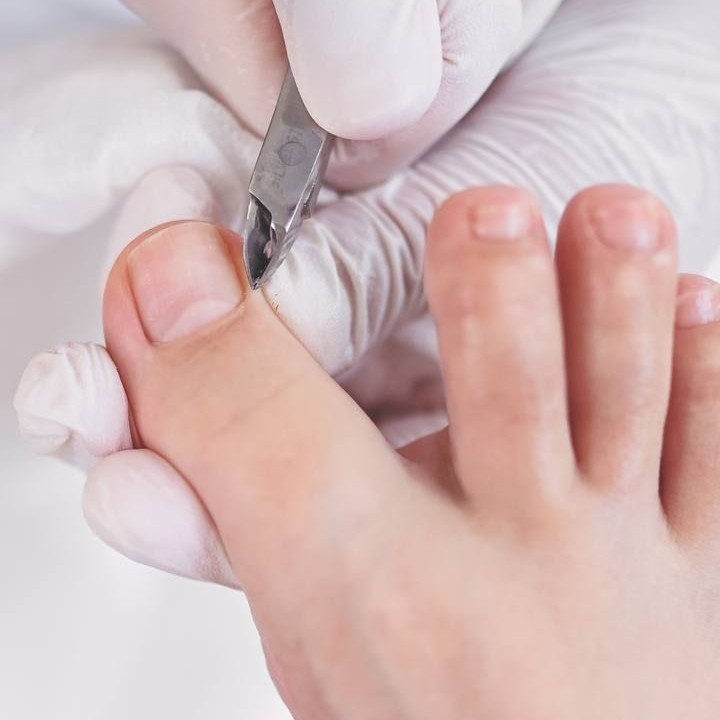 1. МЕДИЦИНСКИЙ ПЕДИКЮР 1 СТЕПЕНИ(МИНИ)