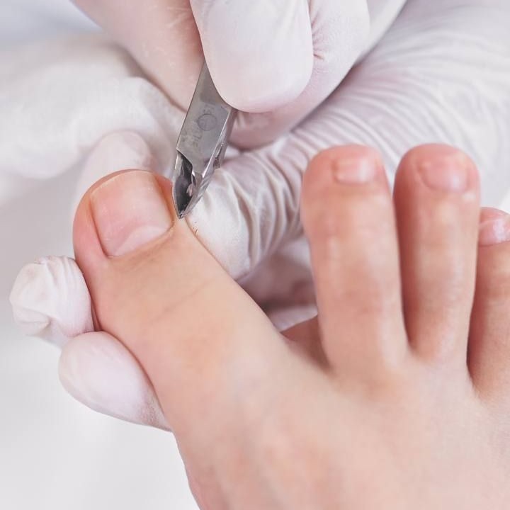 2. МЕДИЦИНСКИЙ ПЕДИКЮР 2 СТЕПЕНИ(СРЕДНЯЯ СЛОЖНОСТЬ)