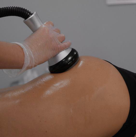 Кавитация бедра