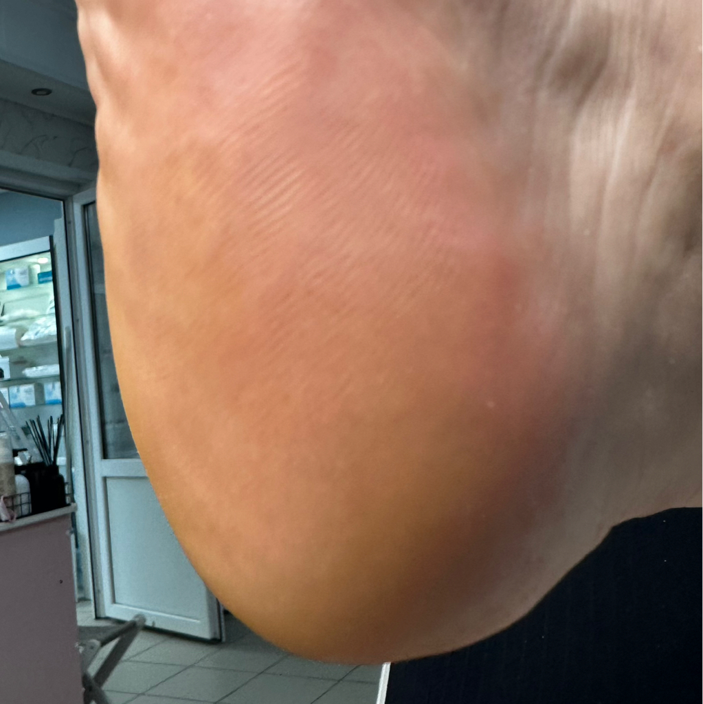 Smarticure стопа+пальчики