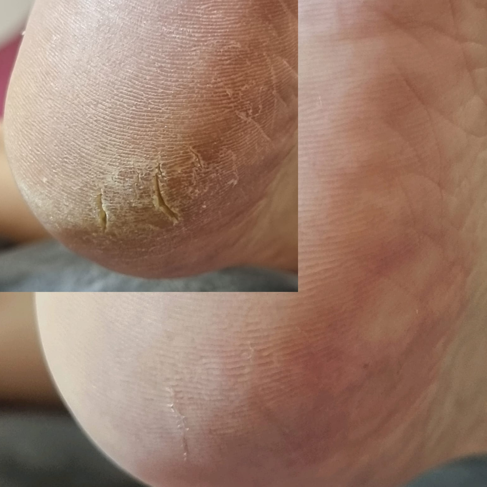 Стопа + пальчики