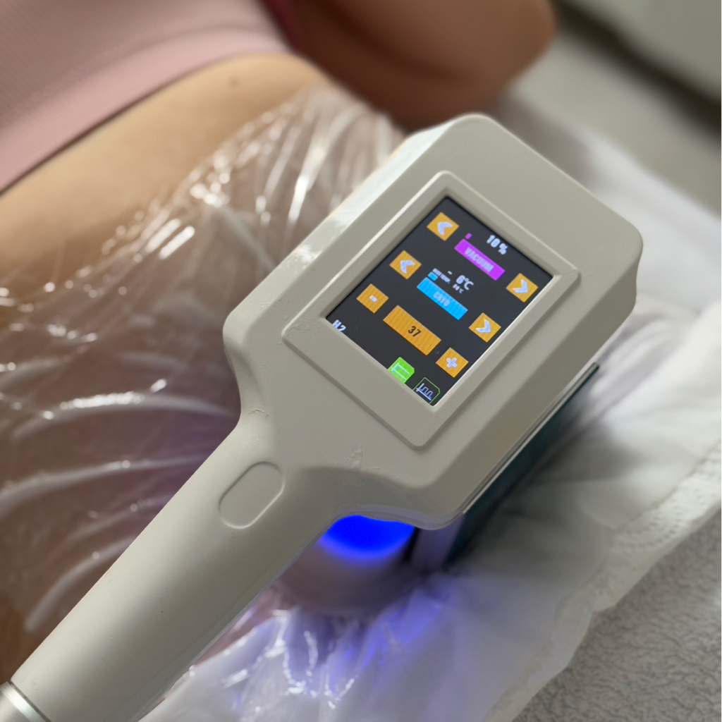 Криолиполиз