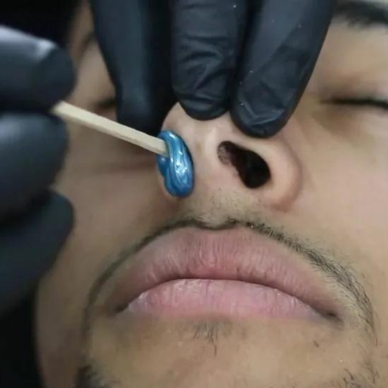 Депиляция воском (1 зона)