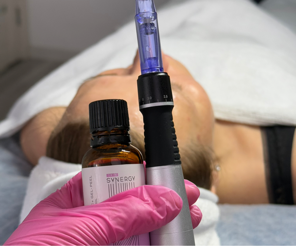 Пилинг с фракционной мезотерапией