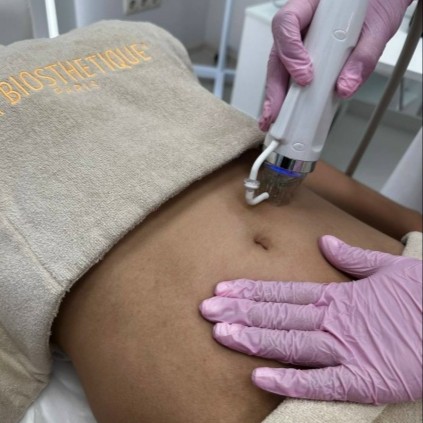 МИКРОИГОЛЬЧАТЫЙ РФ ЛИФТИНГ
ТЕЛО, ЖИВОТ+БОКА